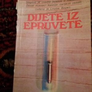 107602948_5fe9177eaad5a4-5383932420201227_211045.jpg Dijete iz Epruvete - R edwards i P. Steptoe