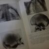89872348_5e2c8d2400d0d9-00770794IMG_20200125_18.jpg Atlas de Radiologie Pediatrica