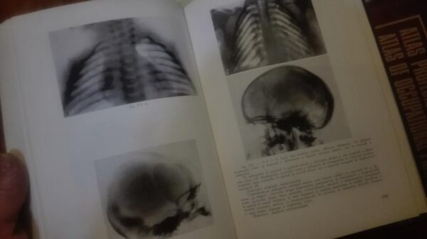 89872348_5e2c8d2400d0d9-00770794IMG_20200125_18.jpg Atlas de Radiologie Pediatrica