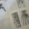 89872348_5e2c8d24069e85-89944297IMG_20200125_18.jpg Atlas de Radiologie Pediatrica