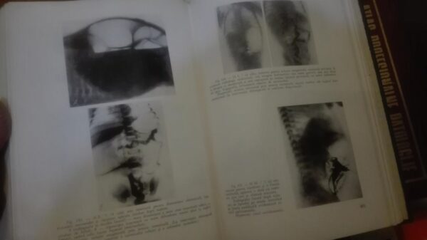 89872348_5e2c8d240b4765-51838040IMG_20200125_18.jpg Atlas de Radiologie Pediatrica