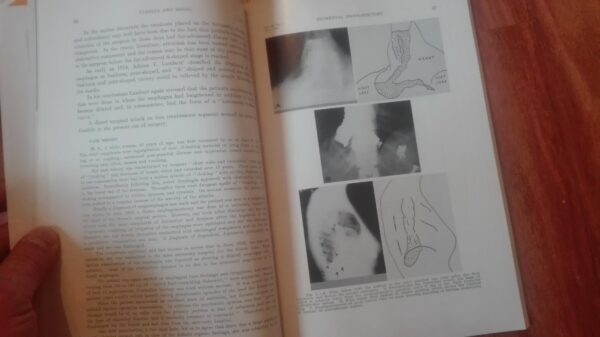 The Juwinal of Thoracic and Cardiovascular Surgery
