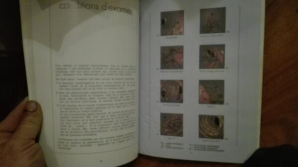92792532_5e791a42409e09-16123045IMG_20200322_18.jpg Atlas Endoscopique tome 1-2-3