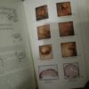 92792532_5e86c688bae8f8-50351373IMG_20200402_21.jpg Atlas Endoscopique tome 1-2-3
