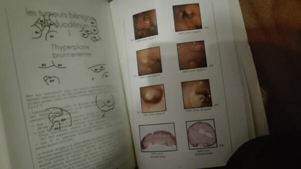 92792532_5e86c688bae8f8-50351373IMG_20200402_21.jpg Atlas Endoscopique tome 1-2-3