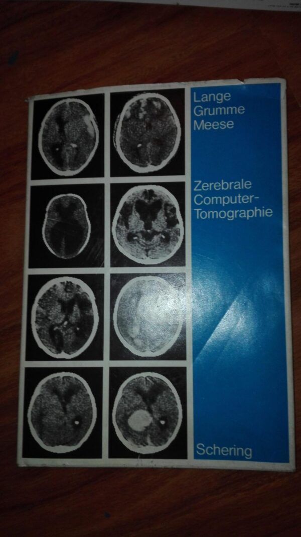 Zerebrale Computer- Tomographie