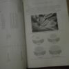 Toracic and Cardiovascular  Surgery