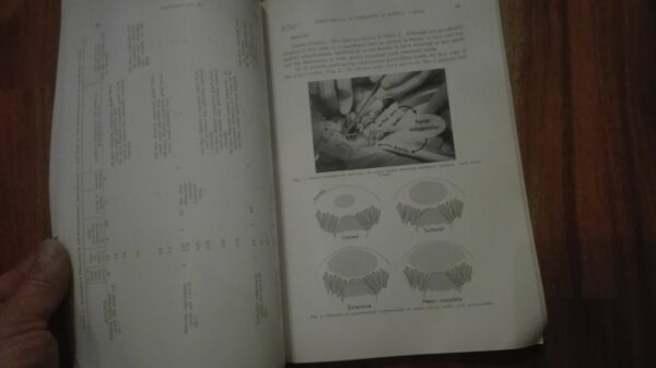 Toracic and Cardiovascular  Surgery
