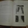Toracic and Cardiovascular  Surgery