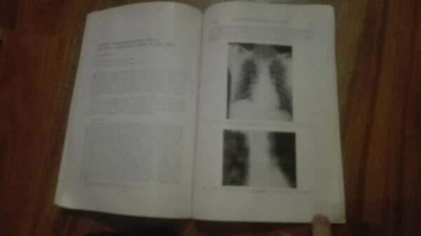 Toracic and Cardiovascular  Surgery
