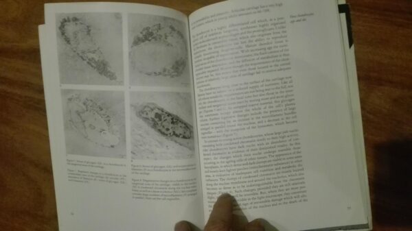 93534874_5e8ebcdad2ee80-19686137IMG_20200407_22.jpg Articular cartilage and Osteoarthrosis