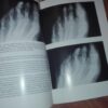 93627794_5e9192d7e80254-04631250IMG_20200410_22.jpg Arthritis Psoriatica
